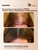 Cыворотка для роста и против выпадения волос FENIXL, 100 мл — изображение 3