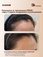 Cыворотка для роста и против выпадения волос FENIXL, 100 мл — изображение 5