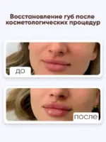 Бальзам для губ от трещин SPF 25, 2,6 г — изображение 5