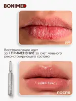 Биоидентичная маска для губ BONIMED AMPULIN 10 мл — изображение 8