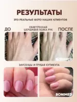 Крем для ног с мочевиной BONIMED REHABER от трещин и сухости — изображение 13