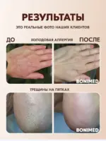 Крем для ног с мочевиной BONIMED REHABER от трещин и сухости — изображение 12