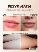 Крем для ног с мочевиной BONIMED REHABER от трещин и сухости — изображение 8