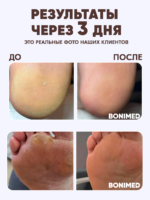 Крем от трещин для стоп, 125 г — изображение 3