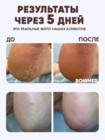 Крем от трещин для стоп, 125 г — изображение 4